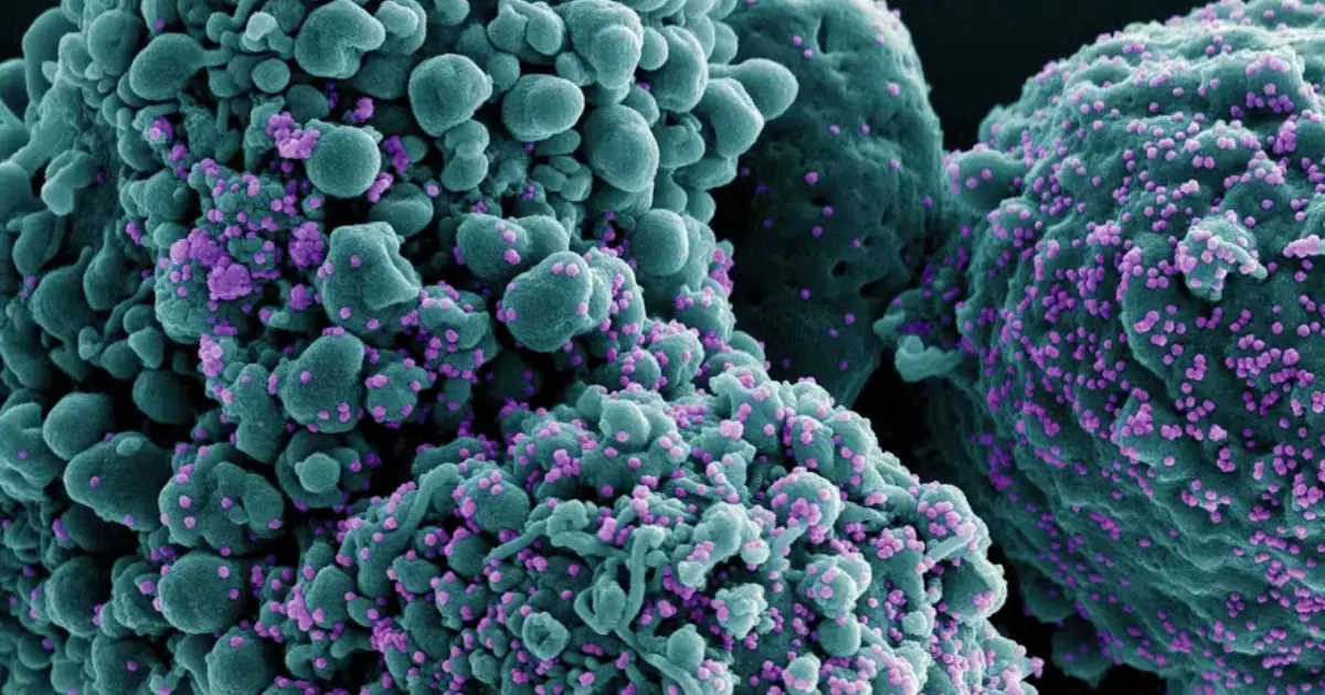 Células humanas azul sendo infectadas pelo coronavírus partículas roxas. — Foto NIAD